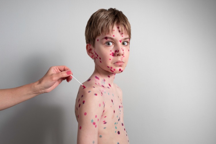 Çocuk İmmünoloji ve Alerjik Hastalıklar